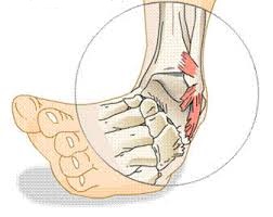 pėdų sąnariai pakenkia gydymui skausmas riešo