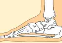 skausmas šlapias pėdų ką daryti skausmas alkūnės sąnario dešinėje epikondilitą
