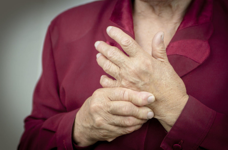 artritas rankų gydymas liaudies gynimo