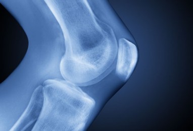 grėsmingas ir crunch sąnarių kokios ligos gydymas artrozė konfigūracijos