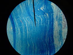 silicio kurio kiekis sąnarių gydymo skauda bendrą petį iš nugaros