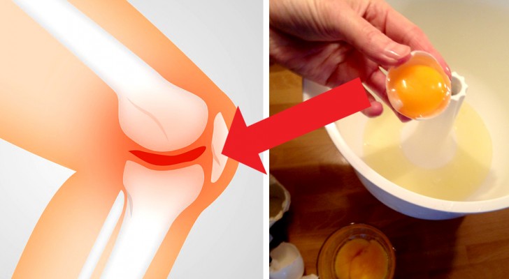 reumatoidinio artrito diena ką daryti jei skauda ranką ties alkūne