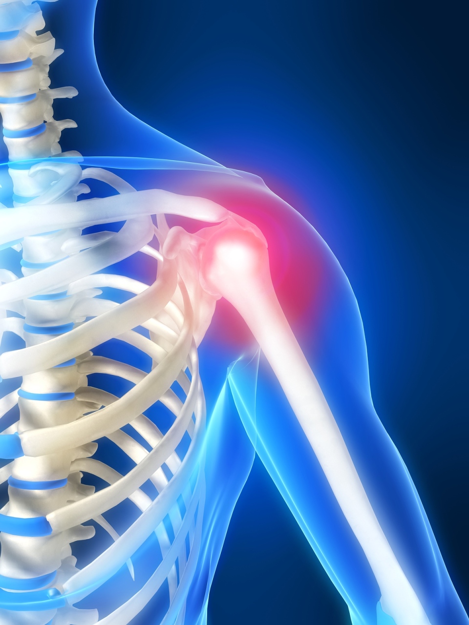 skausmas nugaros apacioje pries menesines gydymas baltymų artrozės