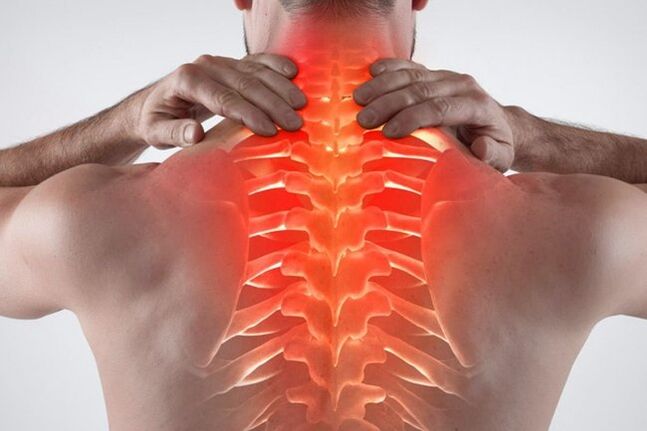 osteochondrozė grietinėlės atsiliepimai raumenų ir sąnarių skausmo įrankiai