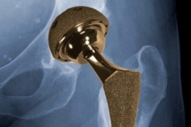 gydymas artritas pirštų rankas liaudies gynimo 38 savaičių gerklės jungtys