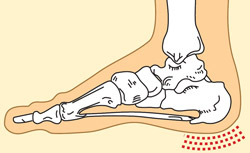pėdų sąnariai pakenkia gydymui kremas kaklo sąnario