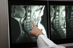 sumažinti kremas osteochondrozė skauda rankas ir sąnarių ranka galus