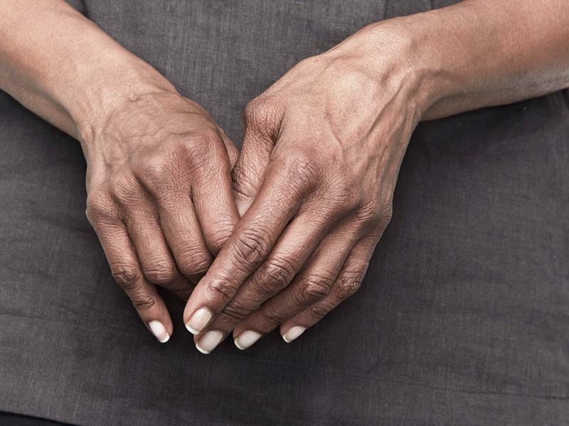 artritas mažų sąnarių rankų