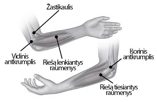 artrozė pėdos sulyginti 1 etapas