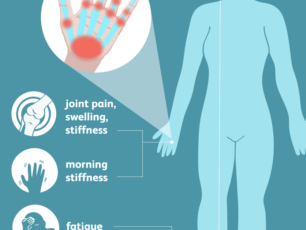 swollen painful joints on one side of body carnation su sąnarių skausmas