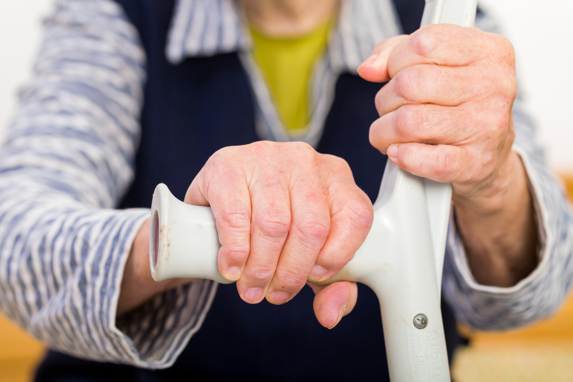 artrozė ir artritas rankos sustaines skauda šepečiai