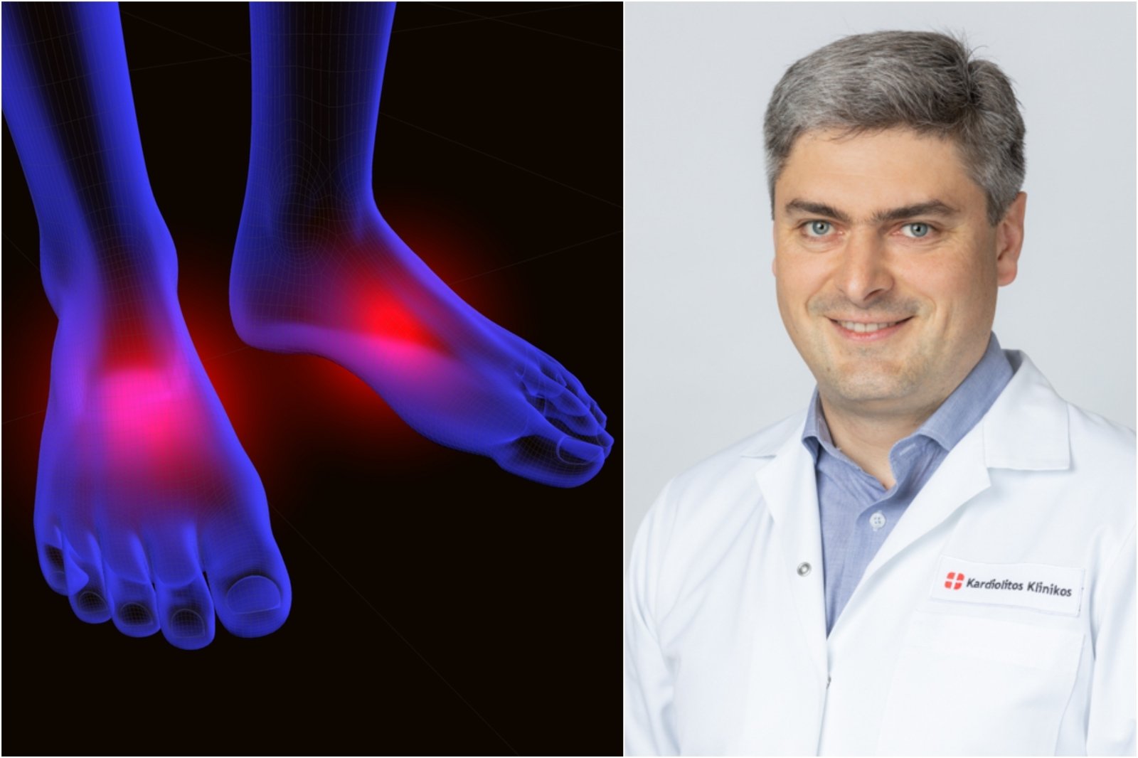 liga pėdos gydymo sąnarių