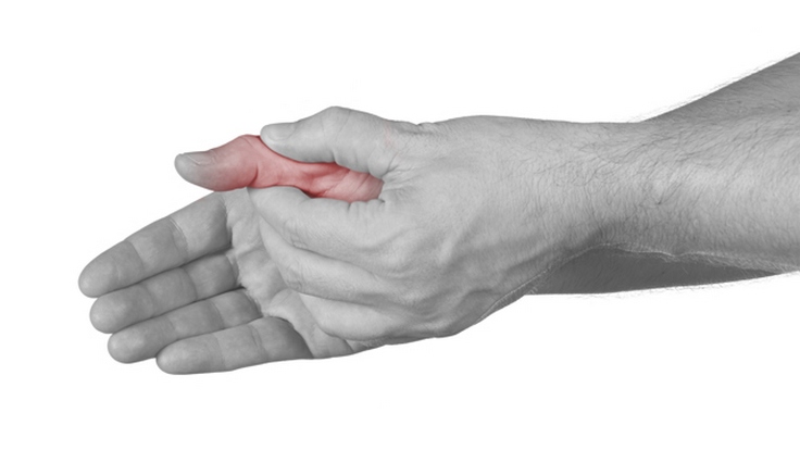 artritas ir alkūnės sąnario kas tai yra bolshaw skausmas skausmas