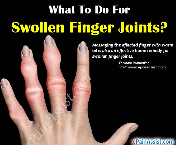 swelling in finger joints causes