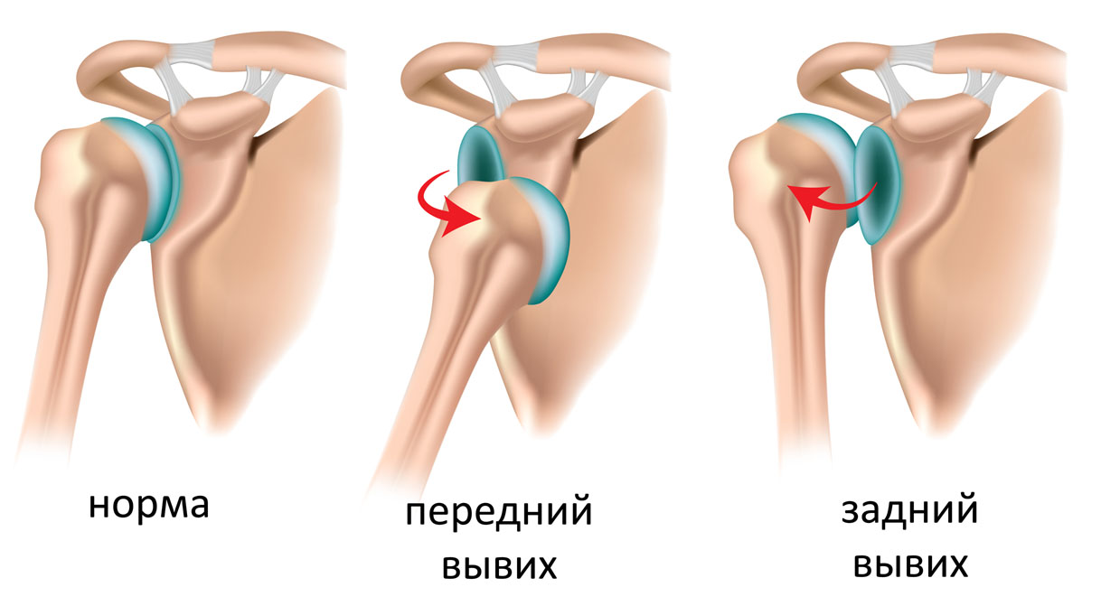 edema in knee joint raumenų skausmas ir sąnarių rankų gydomi liaudies gynimo