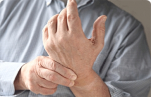 artrito formų sąnarių 16 m gydymas artrozės žmonės
