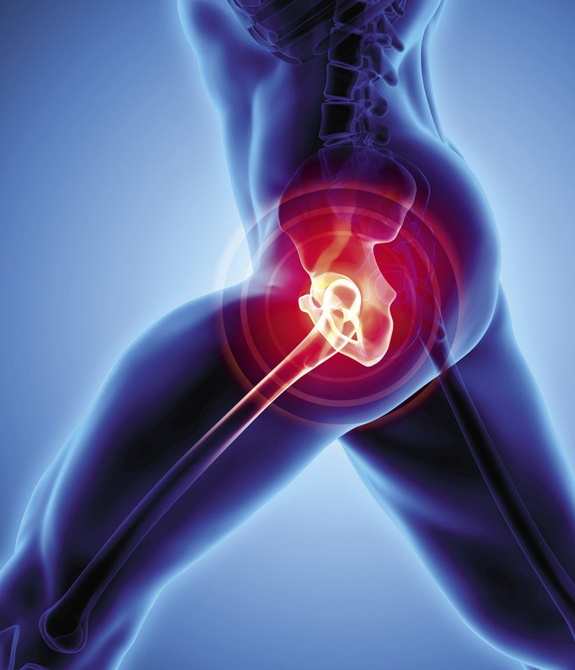 swelling joints osteoarthritis sąnarių uždegimą alergiškiems