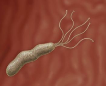 bakterijos causeing sąnarių liga