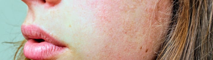 paraudimas ant odos ir sąnarių skausmas