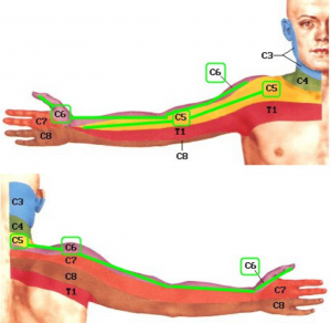 skausmas alkūnės sąnario dešinės rankos aušinimo tepalas su osteochondroze