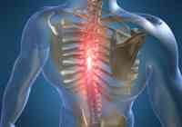 tepalas osteochondrozės kaklo liga atsuka sąnarius