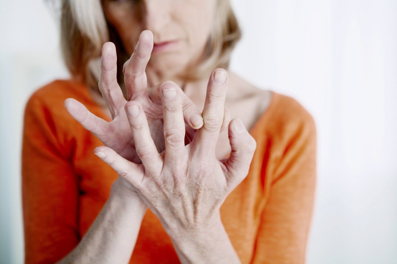 artritas piršto rankos sukelia išvaizdą