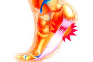 gydymas artrozė kojų homeopatijos
