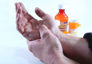 gydymas artrozė poliartritas gydymo artritas šepečių rankos