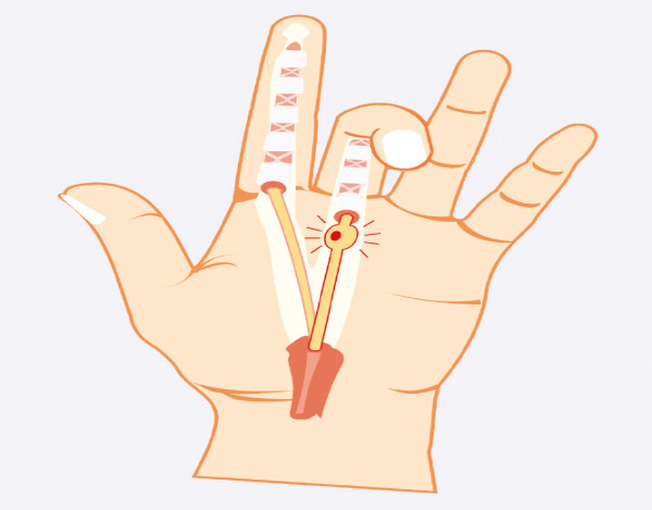 ką daryti jei sąnariai yra traškus ir ranka skauda atsiliepimai apie artrozės gydymo