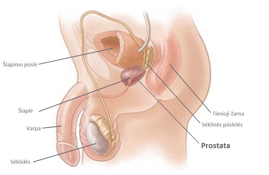 skausmas prostatos ir sąnarių sustav patinimas gydymas liaudies gynimo