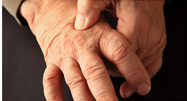 swollen hands painful joints pregnancy