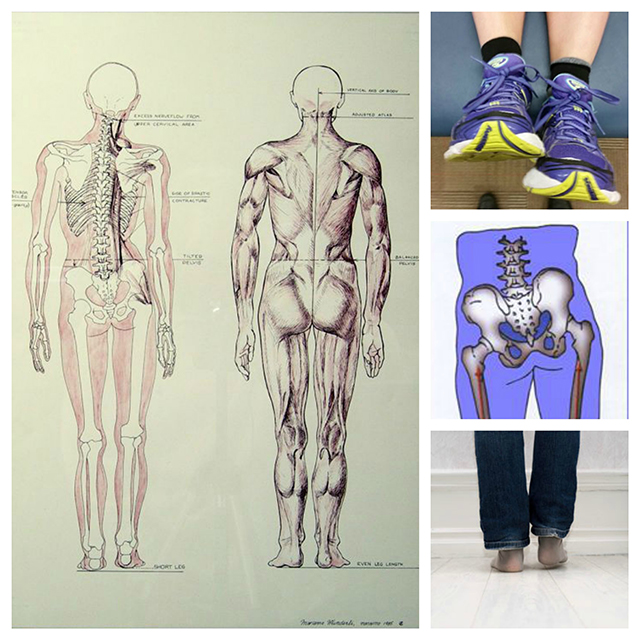 traumos į žmogaus kojų sąnario reabilitacija po ciurnos luzio