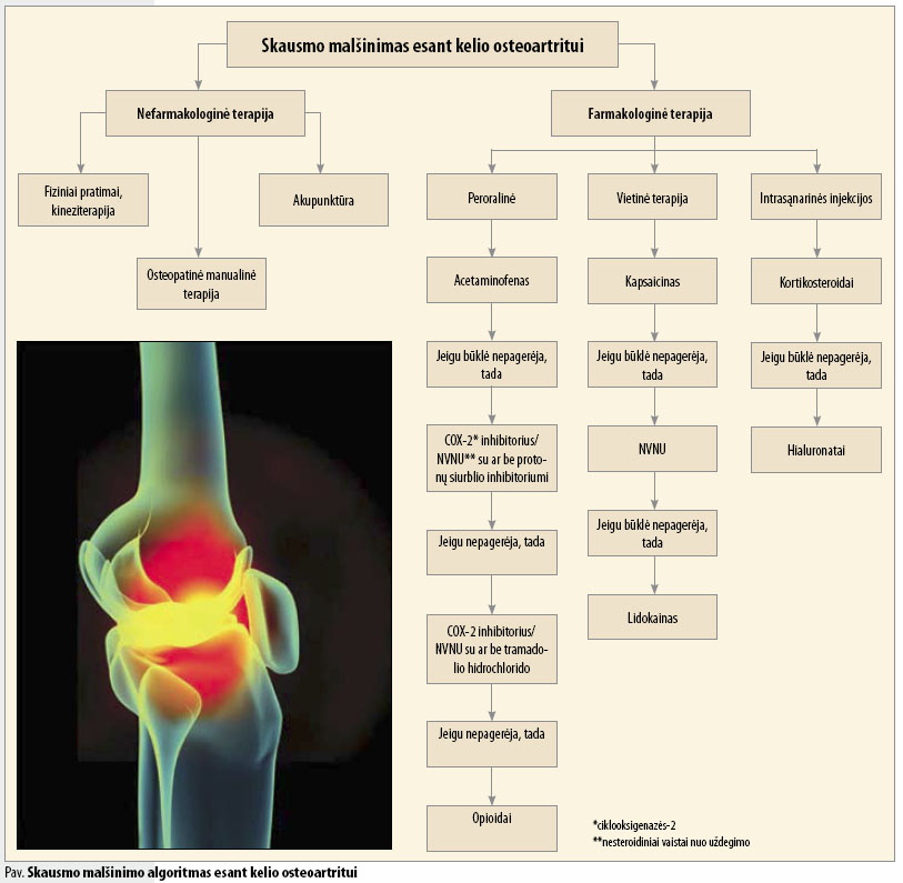 skausmas sąnariuose ir raumenyse gydymas osteoartrozės pėdos sąnarių liaudies gynimo priemones