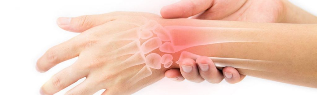 skauda kairiojo riešo sąnarių rankos sąnarių skausmas artrito gydymui