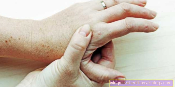 maži sąnarių skauda ant pirštų artritas artrozė gydymas