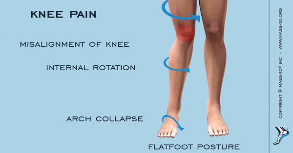 artritas 1 iš falanga sąnario laipsnis vaistai nuo kojų pėdų skausmo