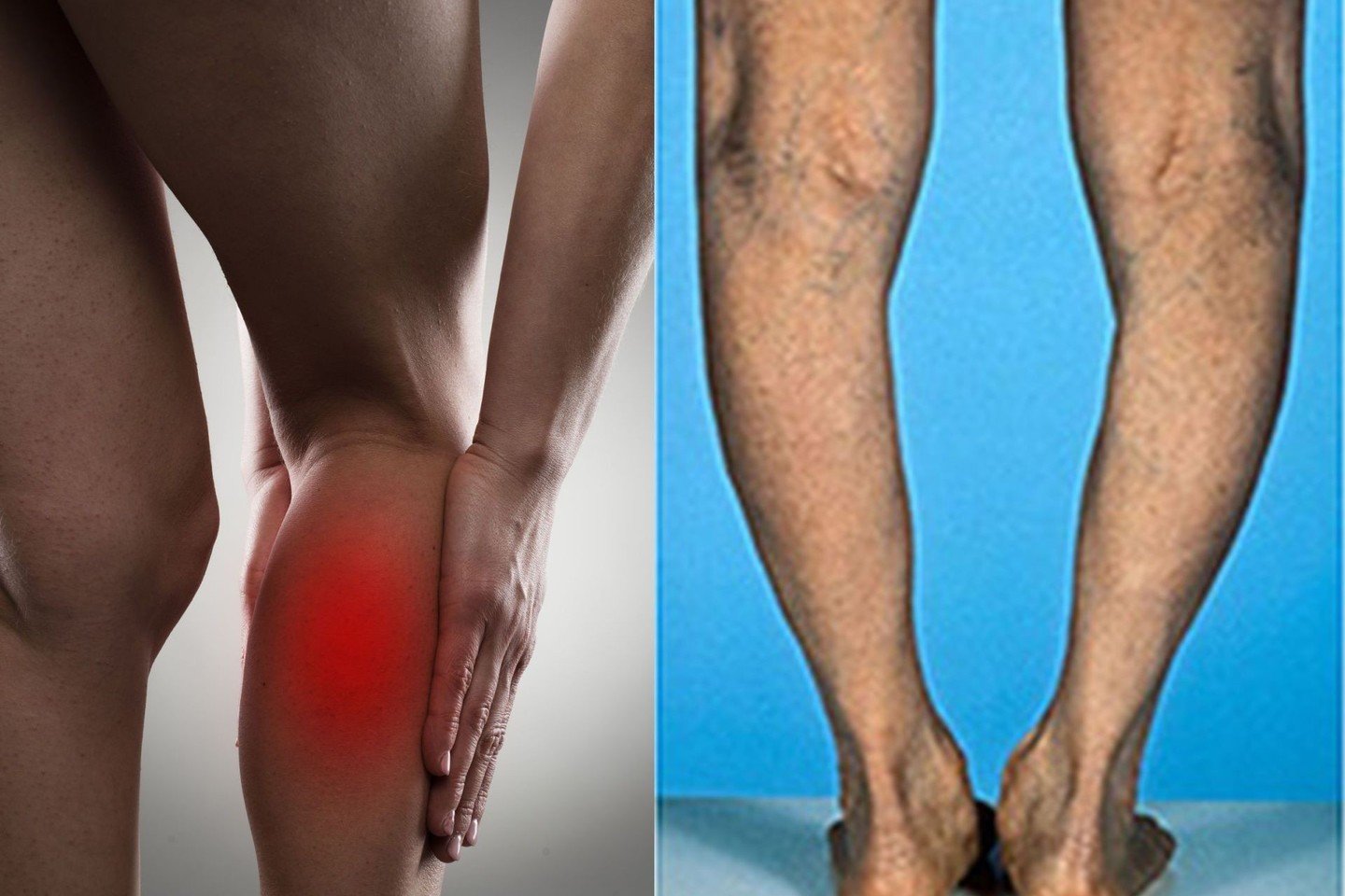 kojos sanariu skausmas artritas piršto rankų priežasčių
