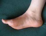 pulsuojanti pėdų skausmas lankstumas ir sąnarių skausmas