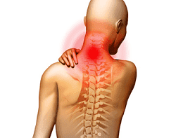 analgetikas tepalas su osteochondroze atsiliepimus lėtinis nuovargis silpnumas raumenų skausmas sąnarių