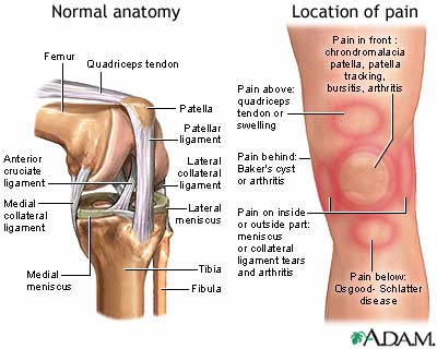 edema in knee joint treatment