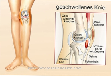 uždegimas bendrą peties gelis iš artrozė kojų gydymas