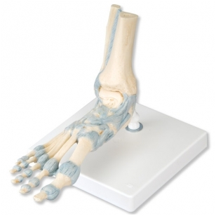 gerklės sąnariuose skeleto artrozė iš rankų riešo gydymo liaudies gynimo