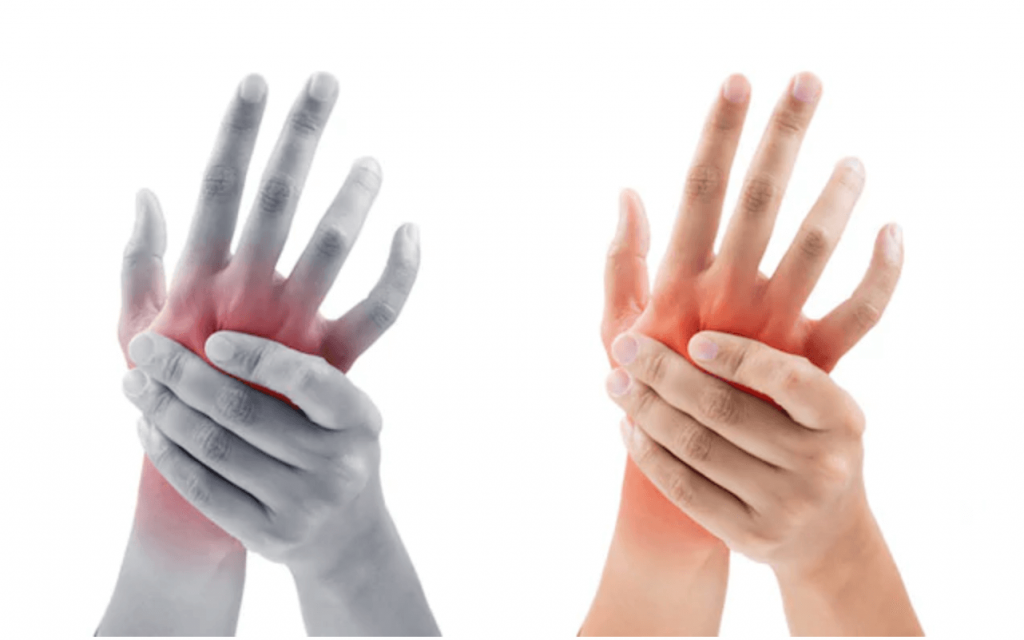 visi kaulai ir sąnariai skauda infekcinio artrito rankų šepečiai