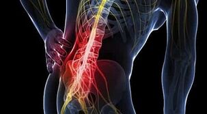 problemos su alkūnės sąnarių liaudies gynimo priemonės nuo sąnarių skausmas artrozės metu