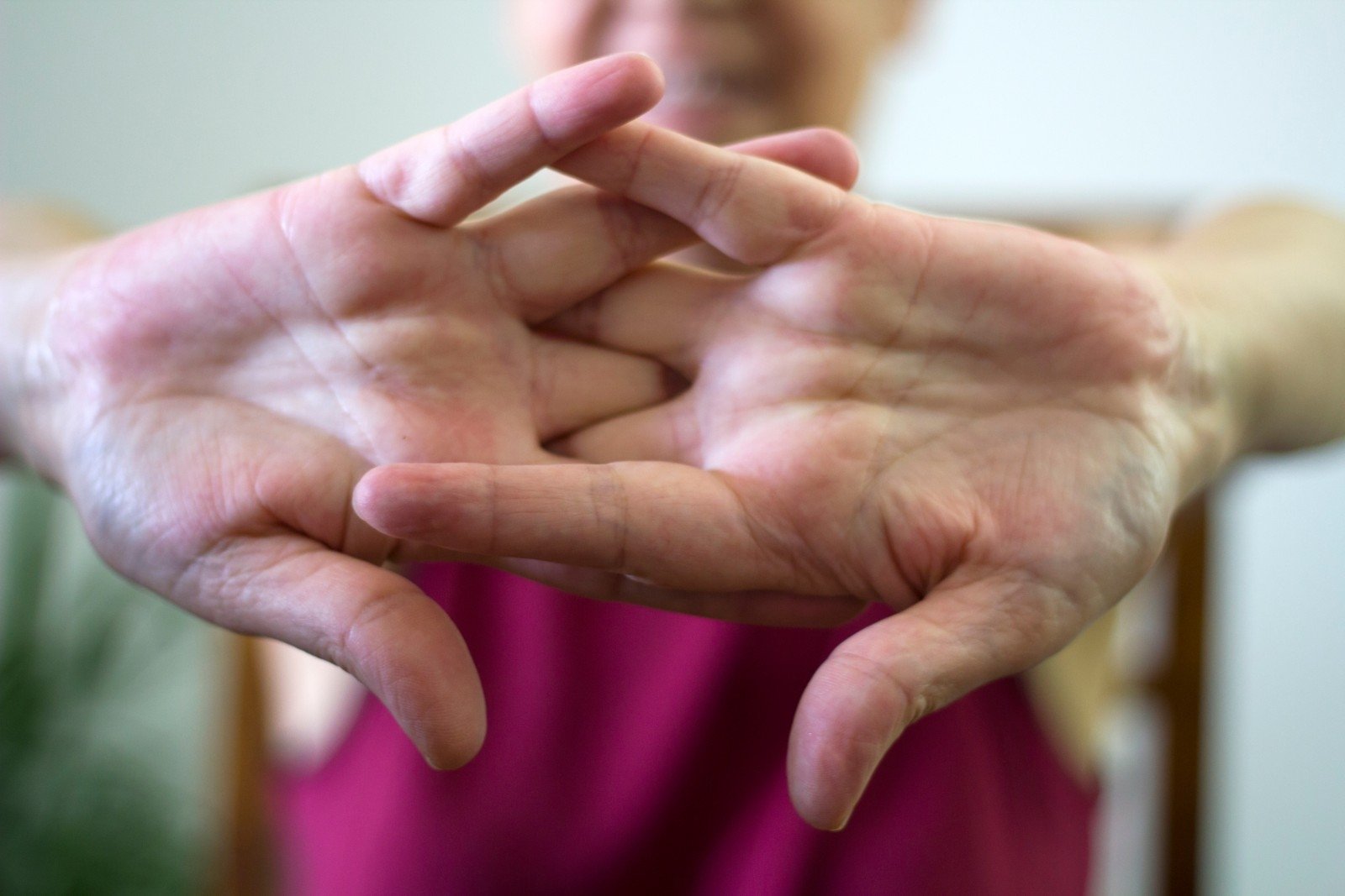 skausmas visame kūne moterims sąnarių sąnarių būklė artrozės metu