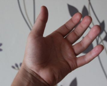 reumatoidinis artritas kairė ranka gydymas poliartritas sąnarių liaudies gynimo priemones