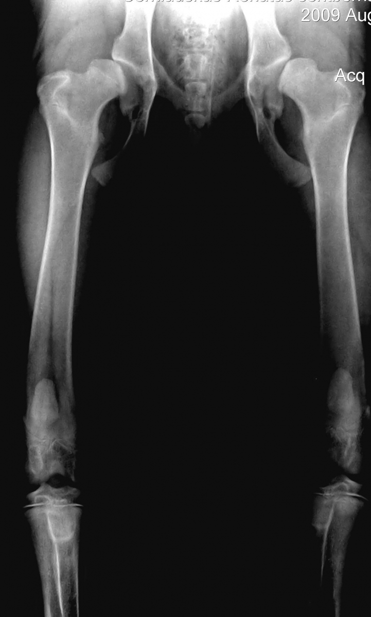 čiurnos osteoartrito gydymui skausmas peties sąnario kai pernešimo atgal gydymas