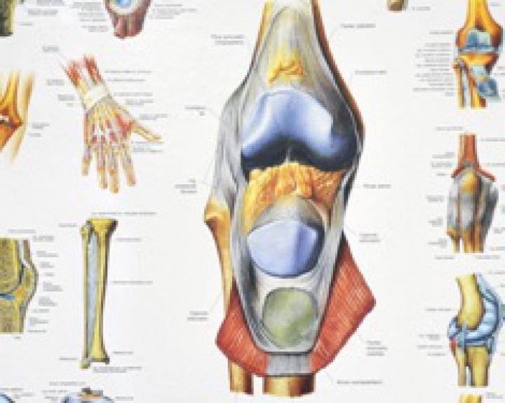 badavimo su osteoartritu rankas sąnarių šildantis tepalas nuo skausmo