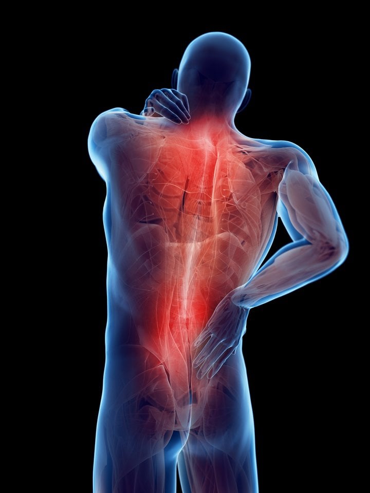 nugaros skausmas ir visi sąnariai vaistai nuo koksartrozes