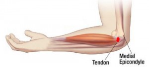 priežastis skausmo alkūnės sąnario artrozė iš kairės kojos
